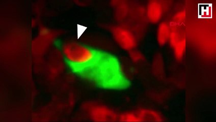 Kanser hücrelerinin nasıl hayatta kaldıkları keşfedildi