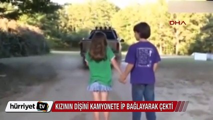 Kızının dişini kamyonete bağlayıp çekti