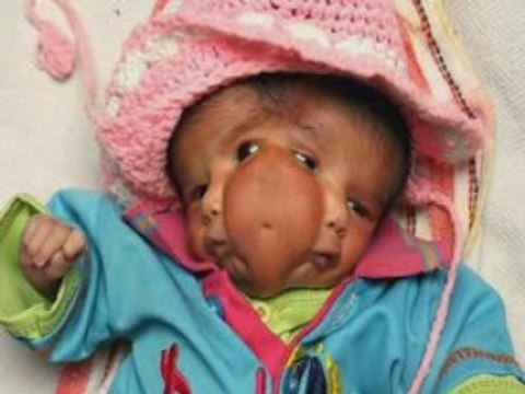 Baby born with four eyes, two mouths and two faces