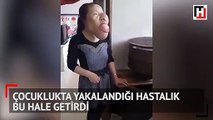 Çocuklukta yakalandığı hastalık bu hale getirdi