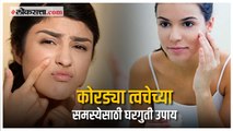 Skin Tips: ‘या’ टिप्स वापरून कोरड्या त्वचेच्या समस्येपासून मिळेल आराम