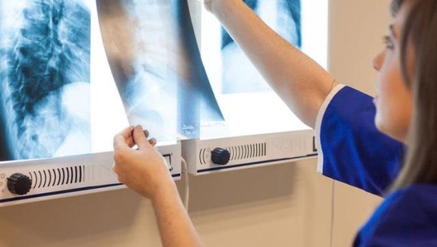 Gözündeki aşırı kaşıntı için hastaneye giden kadın, doktorun dudağından dökülen sözlerle hayatının şokunu yaşadı