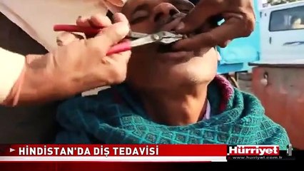 HİNDİSTAN'DA İNANILMAZ DİŞ TEDAVİSİ