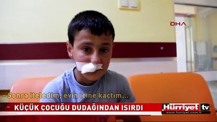 SİBİRYA KURDU DUDAĞINDAN ISIRDI