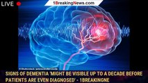 Signs of dementia 'might be visible up to a DECADE before patients are even diagnosed' - 1breakingne