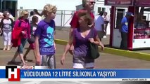 VÜCUDUNDA 12 LİTRE SİLİKON İLE YAŞIYOR