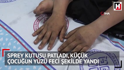 Sprey kutusu bu hale getirdi