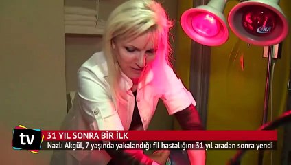 31 yıl sonra fil hastalığını yendi