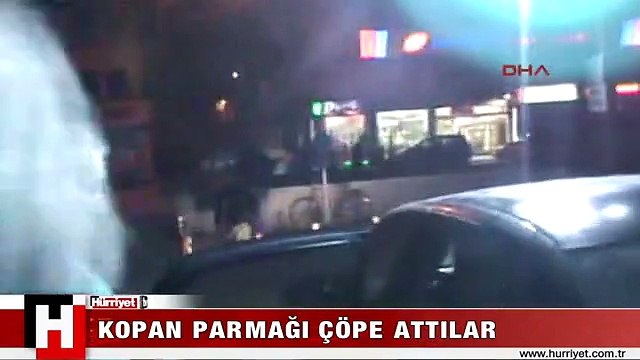 KOPAN PARMAĞI HASTANEDE UNUTULDU