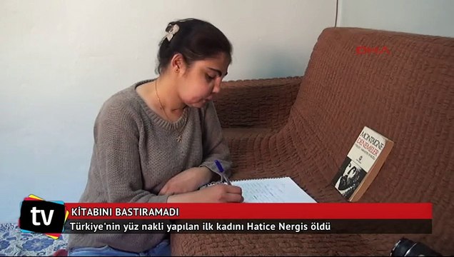 Türkiye'nin yüz nakli yapılan ilk kadını Hatice Nergis öldü