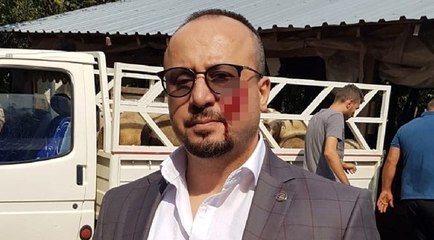 Hacze gelen avukatı ısırmıştı, cezası belli oldu
