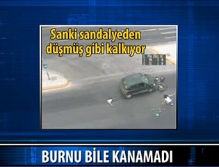 BURNU BİLE KANAMADI