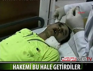 HAKEMİ HASTANELİK ETTİLER