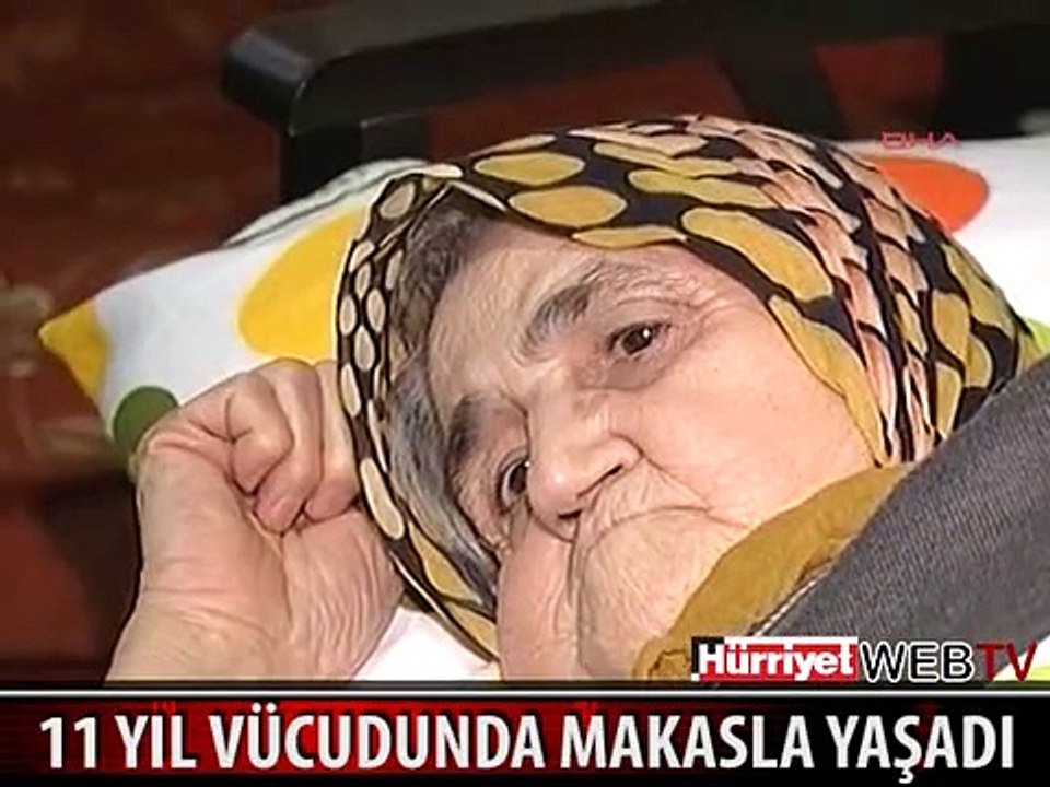 11 YIL VÜCUDUNDA MAKASLA YAŞADI
