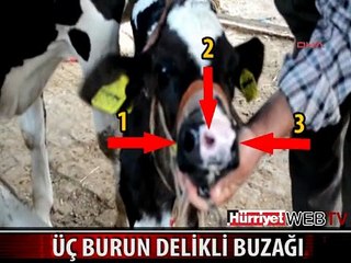 BU OLAY TIP LİTERATÜRÜNE GEÇECEK