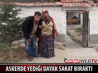 KOMUTAN DAYAĞI SAKAT BIRAKTI
