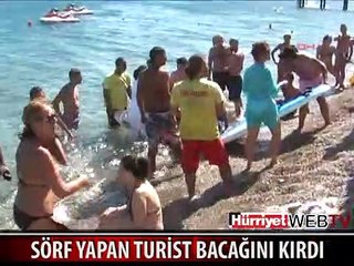 TURİST SÖRF YAPARKEN DÜŞTÜ BACAĞINI KIRDI