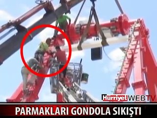 PARMAKLARI GONDOLA SIKIŞTI