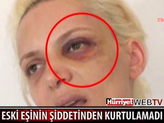 5 YIL ÖNCE BOŞANDIĞI KARISINI BU HALE GETİRDİ