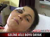 GELİNE ÇOCUKLARININ GÖZÜ ÖNÜNDE DAYAK