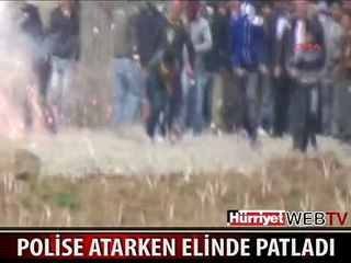 POLİSE ATACAĞI BOMBA ELİNDE PATLADI