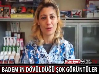 FOK BADEM'İN DÖVÜLDÜĞÜ ŞOK GÖRÜNTÜLER