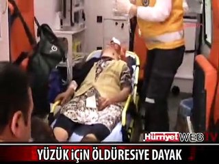 YÜZÜK İÇİN YAŞLI KADINI BU HALE GETİRDİLER