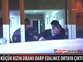 HER ŞEY YEDİĞİ DAYAK SONRASI ORTAYA ÇIKTI