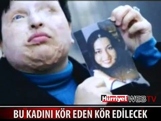 BU KADINI KÖR EDEN KÖR EDİLECEK