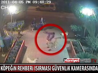 KÖPEK REHBERİN BACAĞINI ISIRDI