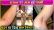 Not A Good Birthday ! Urfi Javed Gets Rashes On Her Body Due To Weird Dress