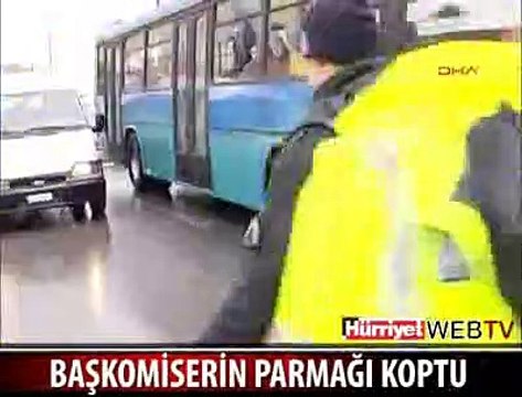 BAŞKOMİSERİN PARMAĞI KOPTU