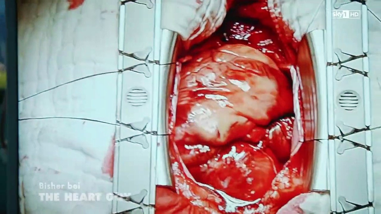 The Heart Guy Staffel 1 Folge 6 HD Deutsch