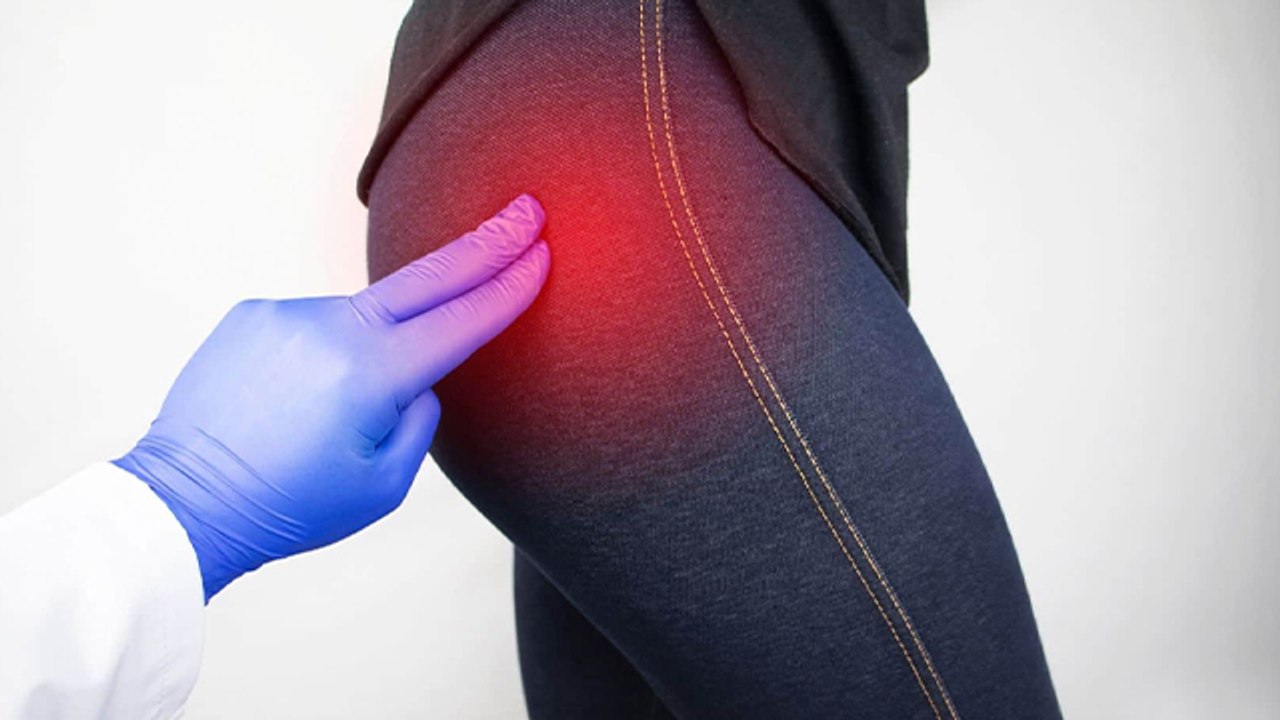 कूल्हे में दर्द किस बीमारी का लक्षण | Hip Bursitis कैसे होता है | Boldsky *health