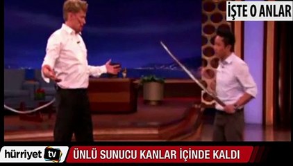 Conan O'brien canlı yayında kanlar içinde kaldı
