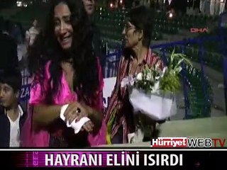 ROJİN'İN ELİNİ ISIRDI