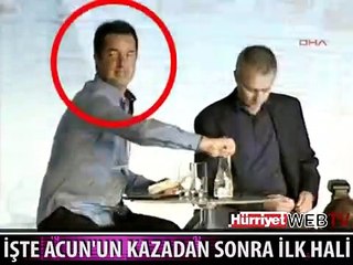 İŞTE ACUN'UN KAZADAN SONRAKİ HALİ