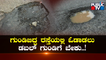 ಸಿಲಿಕಾನ್ ಸಿಟಿಯಲ್ಲಿ ರಸ್ತೆ ಗುಂಡಿಗಳದ್ದೇ ದರ್ಬಾರ್ | Potholes | Bengaluru | Public TV
