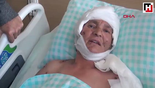 Köpeklerin saldırısında ağır yaralanan kadın