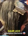 Hair Lice Infestation Removal