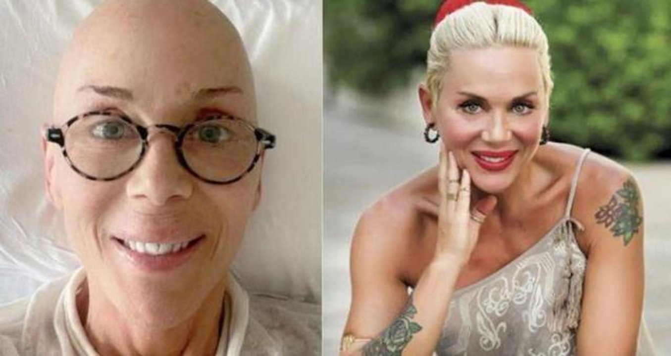 Billur Kalkavan ne kanseriydi? Billur Kalkavan ne zaman kanser oldu? Billur Kalkavan hastalığı neydi?