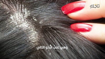 زيت القمل_ أفضل زيوت للقضاء على القمل بسرعة!