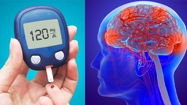 डायबिटीज टाइप 3 क्या है ? टाइप 3 डायबिटीज के लक्षण । Type 3 Diabetes Symptoms । Boldsky *Health