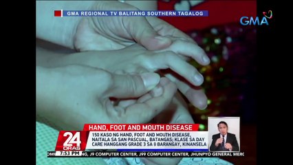 150 kaso ng hand, foot and mouth disease, naitala sa San Pascual, Batangas; klase sa day care hanggang grade 3 sa 8 barangay, kinansela | 24 Oras