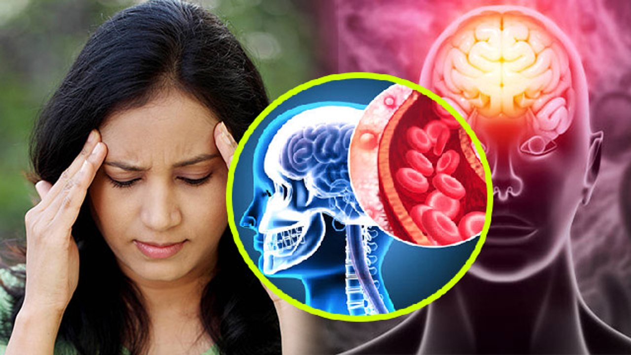 दिमाग में सूजन क्यों होती है , दिमाग में सूजन का ये लक्षण जानकर उड़ेंगे होश |boldsky*Health