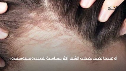 فراغات الشعر الأسباب والعلاج