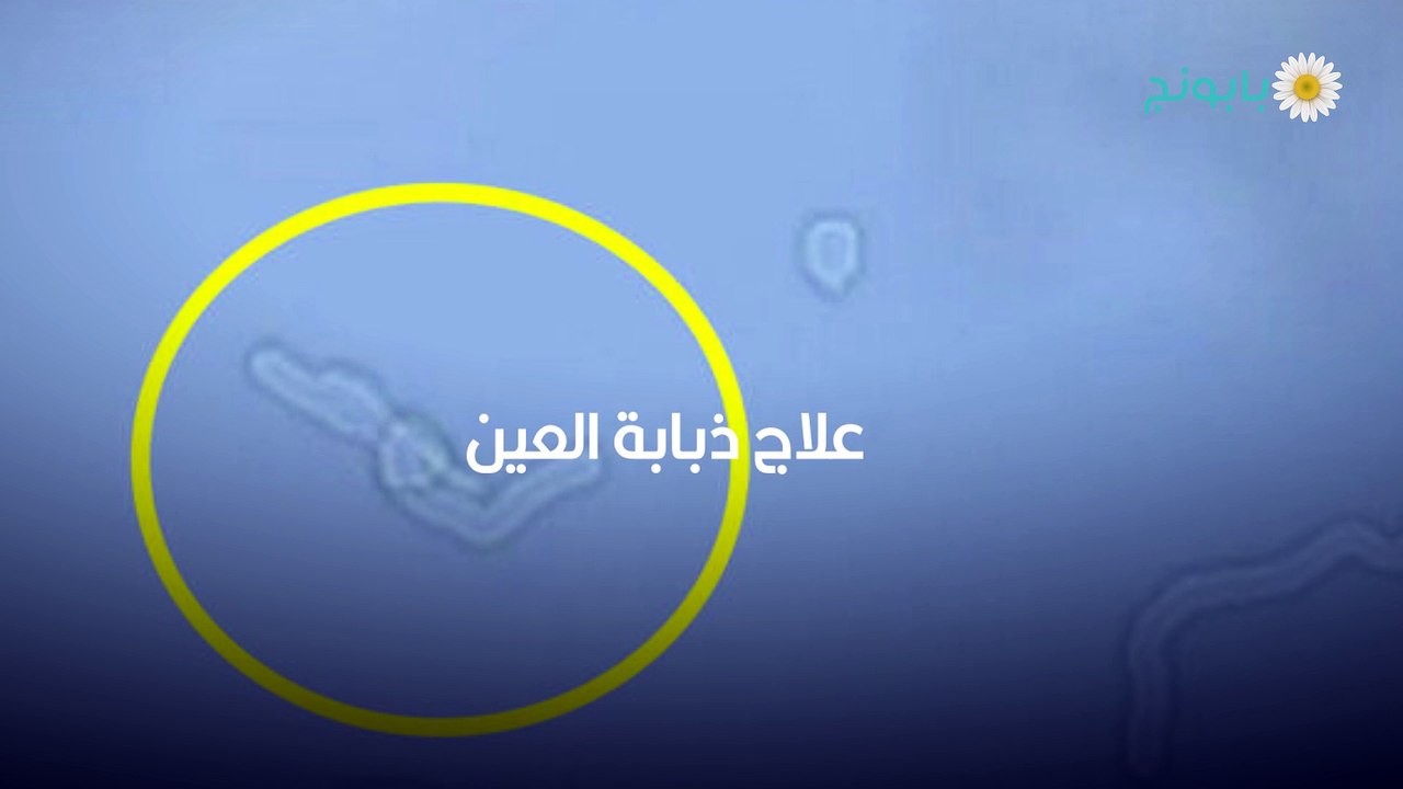 ذباب العين