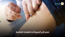 الإبر الصينية لعلاج خشونة الركبة وفوائد استخدامها