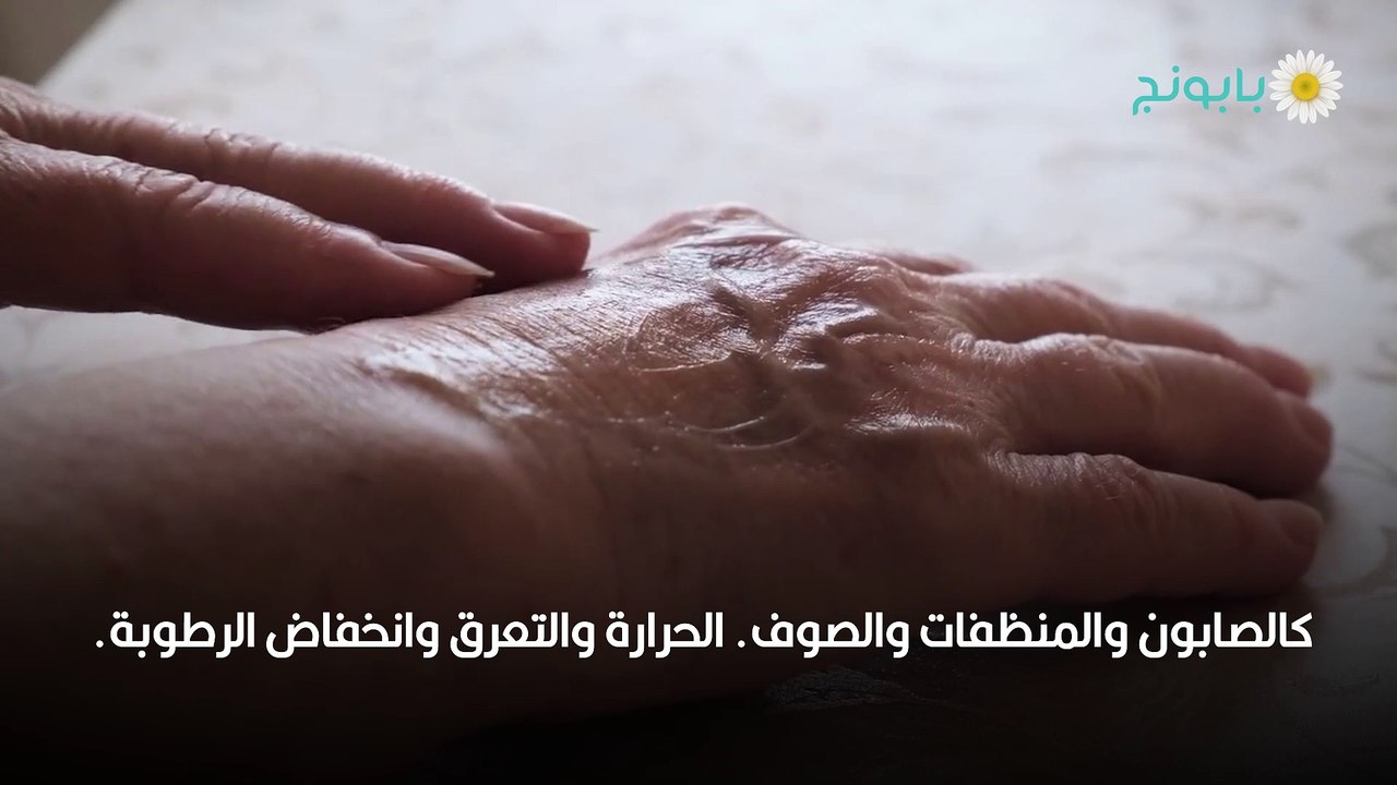 الاكزيما وزيت الزيتون