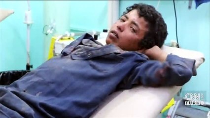 Yemen'de açlık krizi!